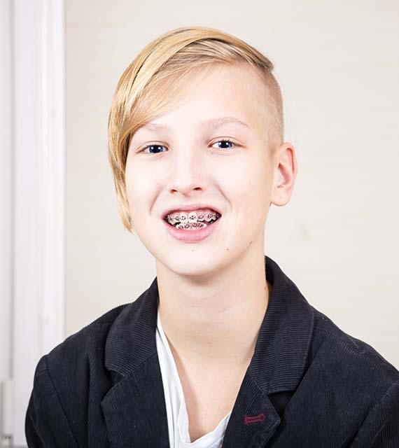 Braces Testimonial - Braces for Teens in Rockford & Grand Rapids MI - Heinz Orthodontics