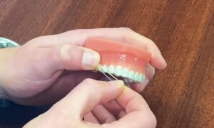 Helpful Elastics Hack for Invisalign and Spark Clear Aligner Wearers