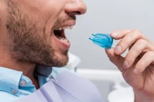 5 Tips for Keeping Track of Your Retainer