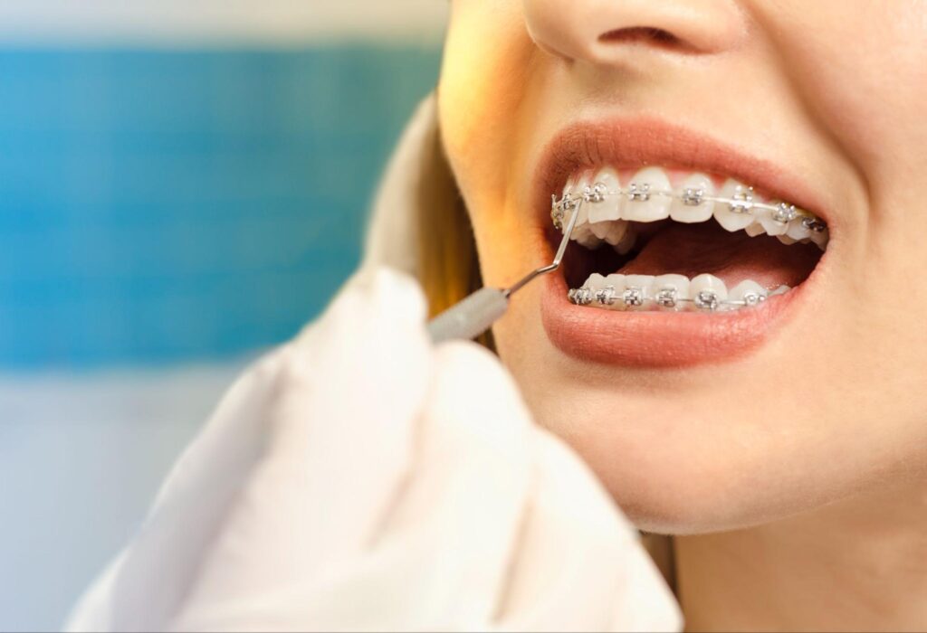 5 Ways to Make Orthodontics More Affordable