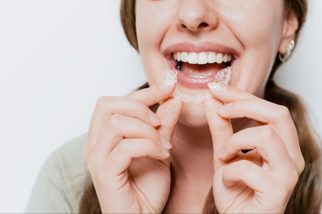 Why Are Clear Aligners Popular