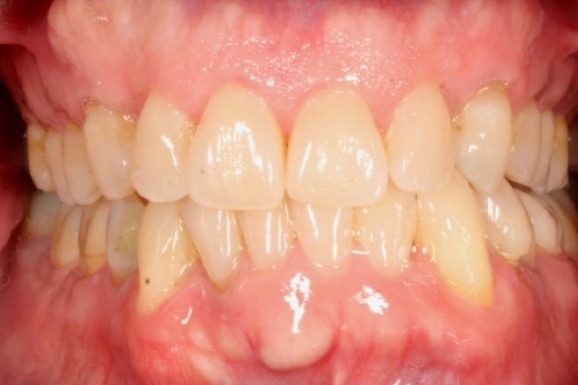Before & Afters