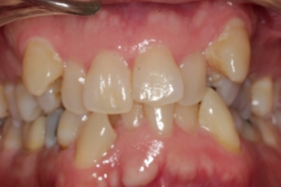 Before & Afters