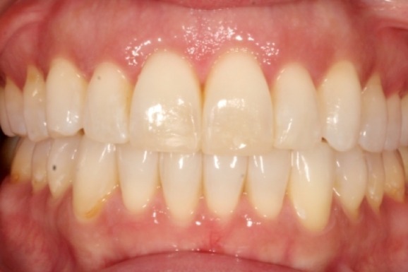 Before & Afters