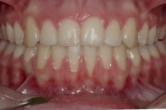 Before & Afters