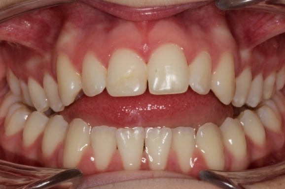 Before & Afters