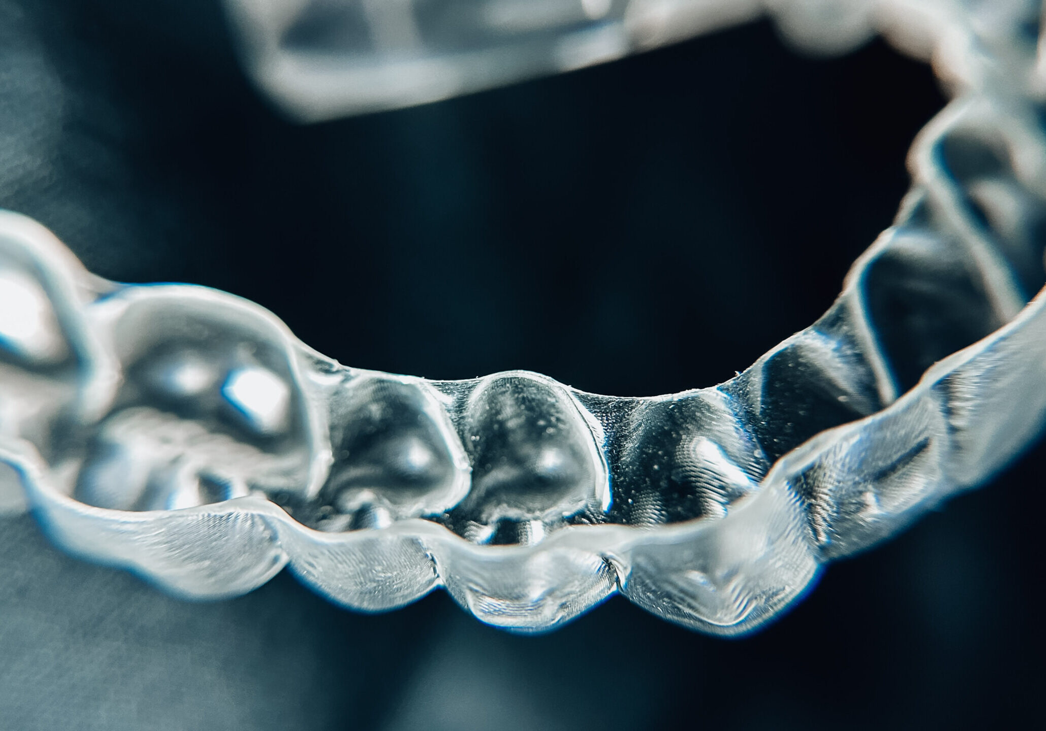 Clear Aligners