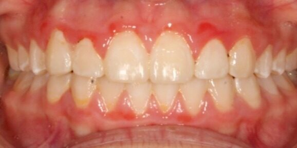Before & Afters