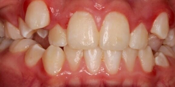 Before & Afters