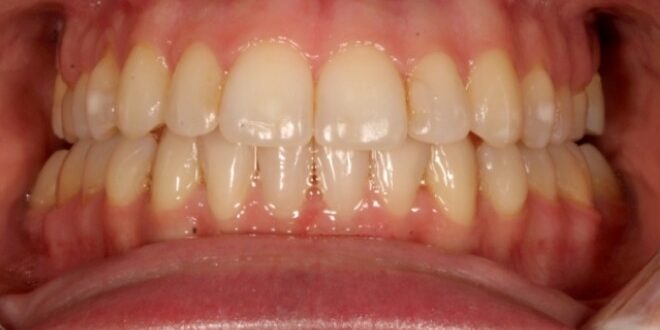 Before & Afters