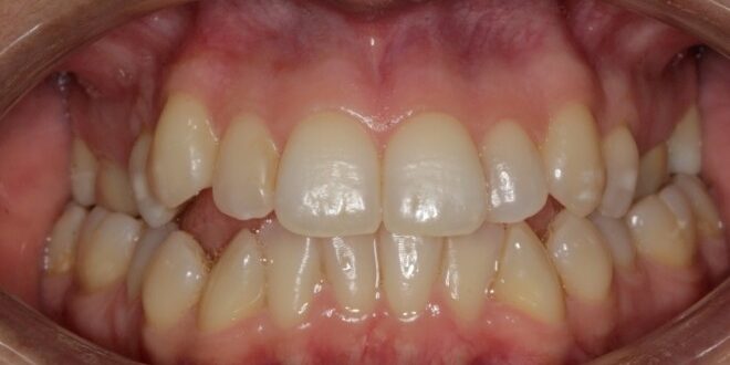 Before & Afters