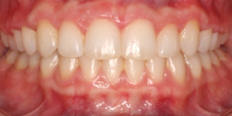 Before & Afters