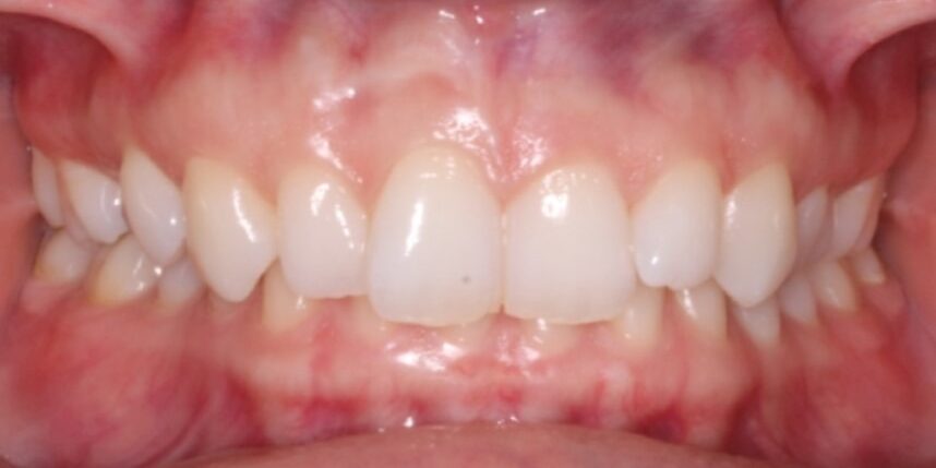 Before & Afters